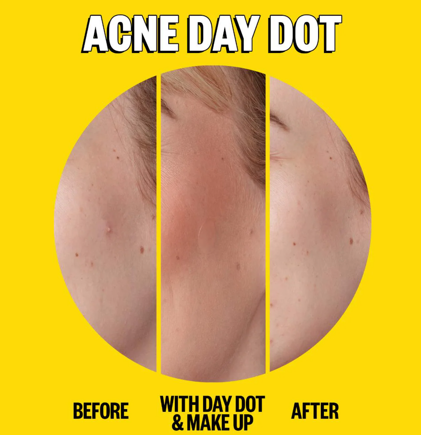 Peace Out Acne Salicylic Acid Day & Night Duo