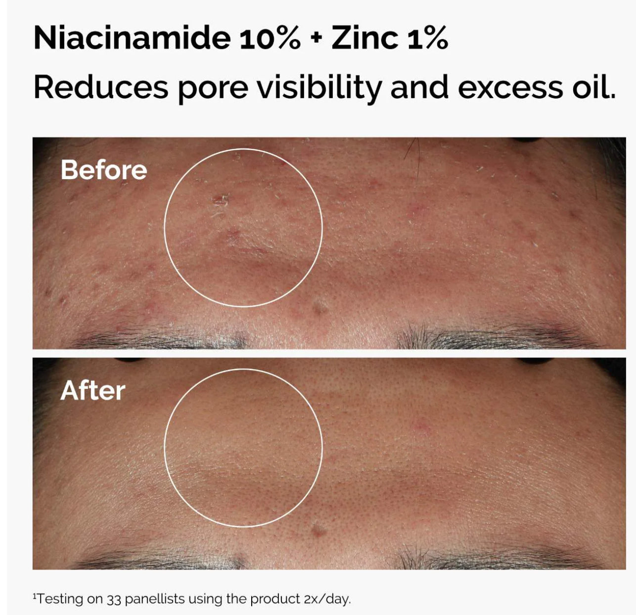 The Ordinary
The Skin Support Set with Niacinamide + Hyaluronic Acid