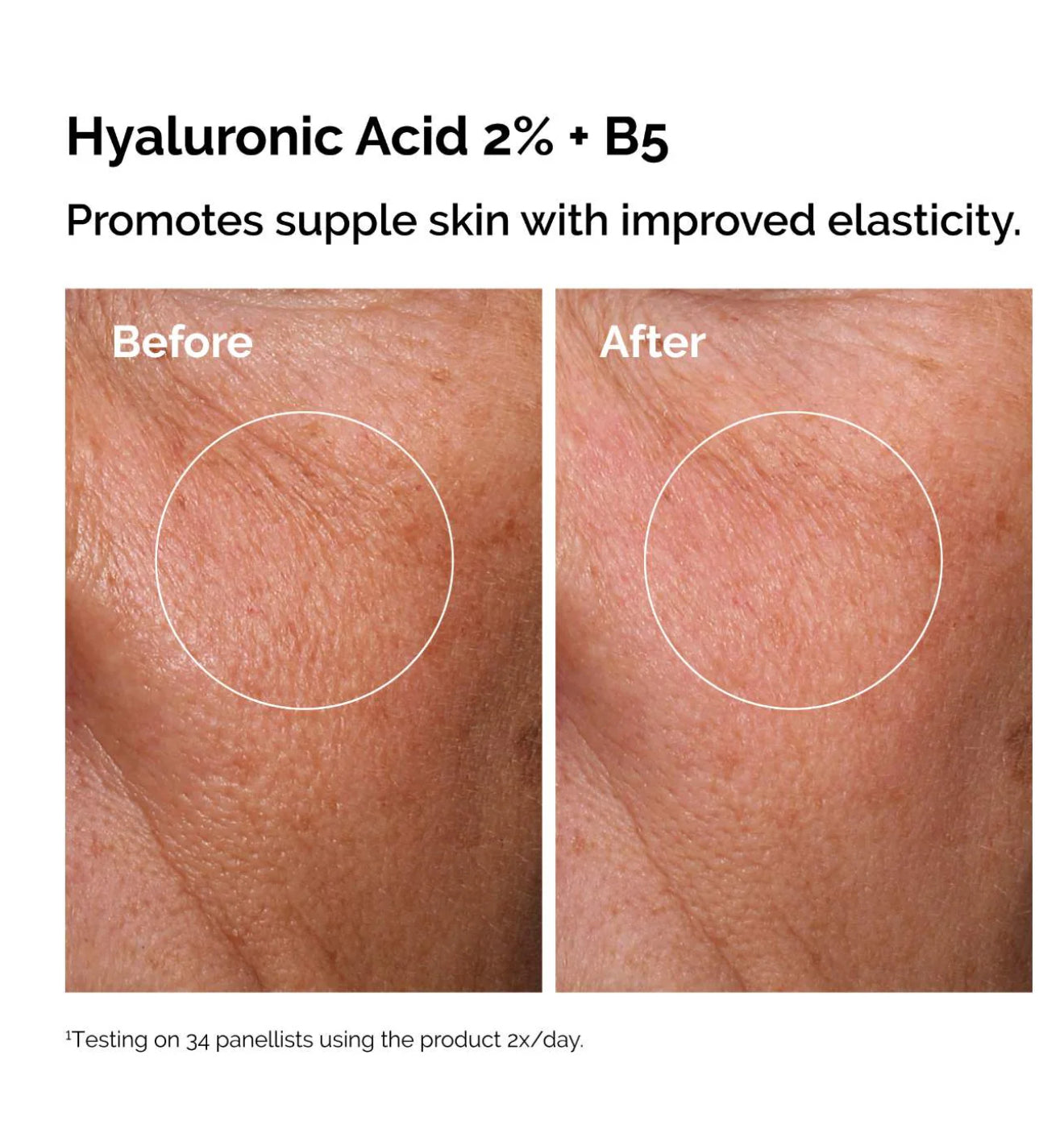 The Ordinary
The Skin Support Set with Niacinamide + Hyaluronic Acid