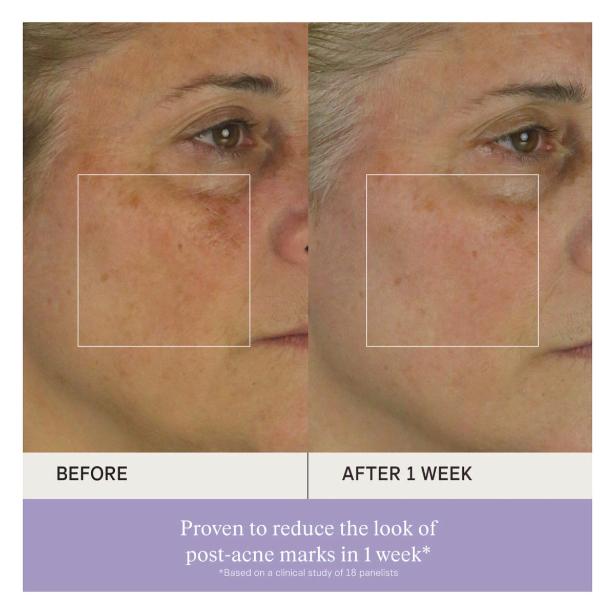 Tatcha 
Brightening & Firming Vitamin-C Serum with Ferulic Acid