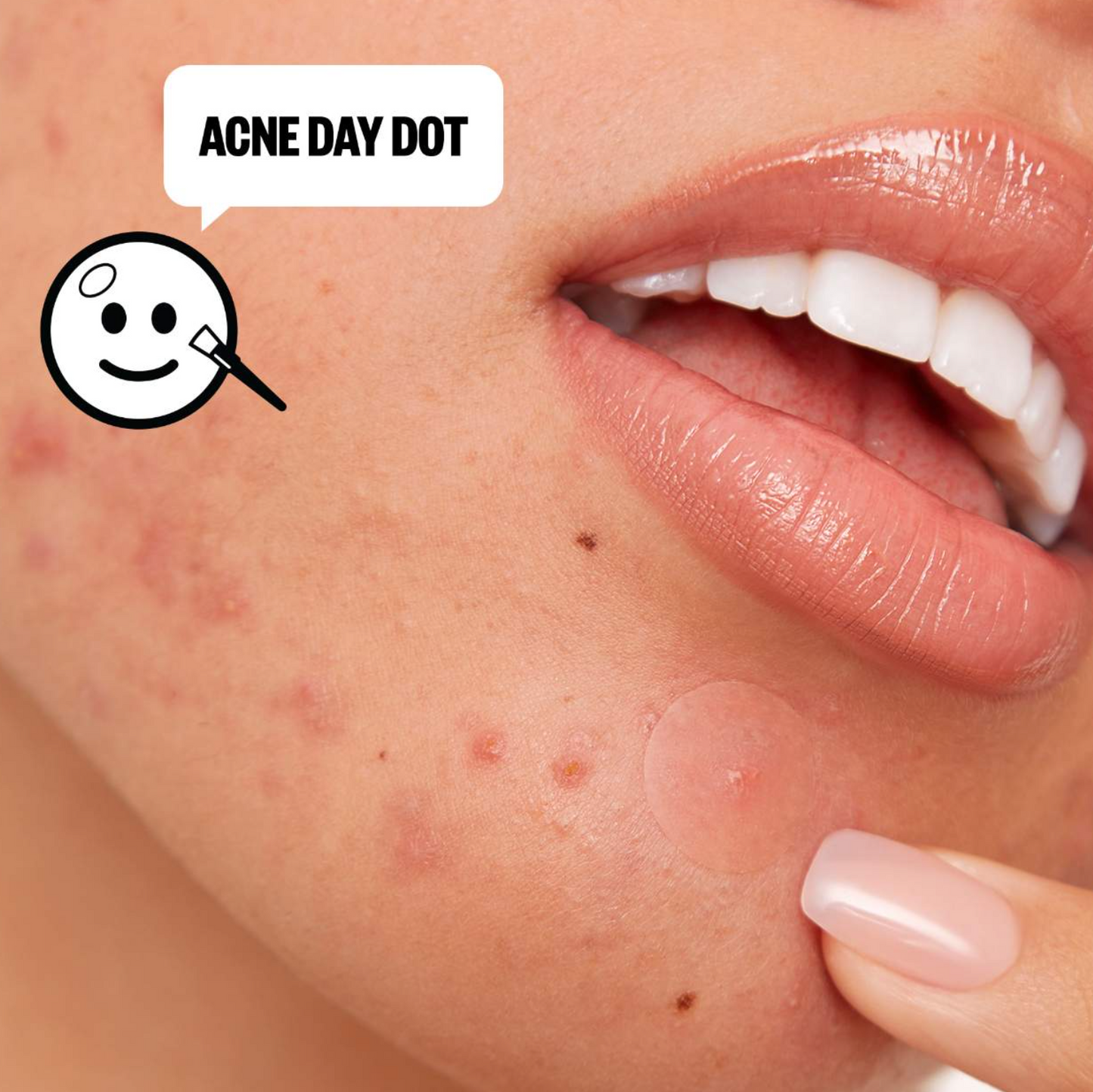 Peace Out  Acne Salicylic Acid Day & Night Duo