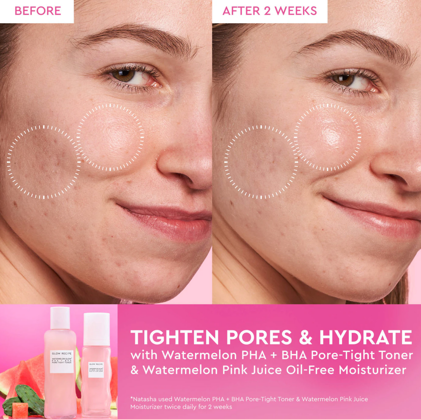 Glow Recipe  Holiday Skin Prep Vault