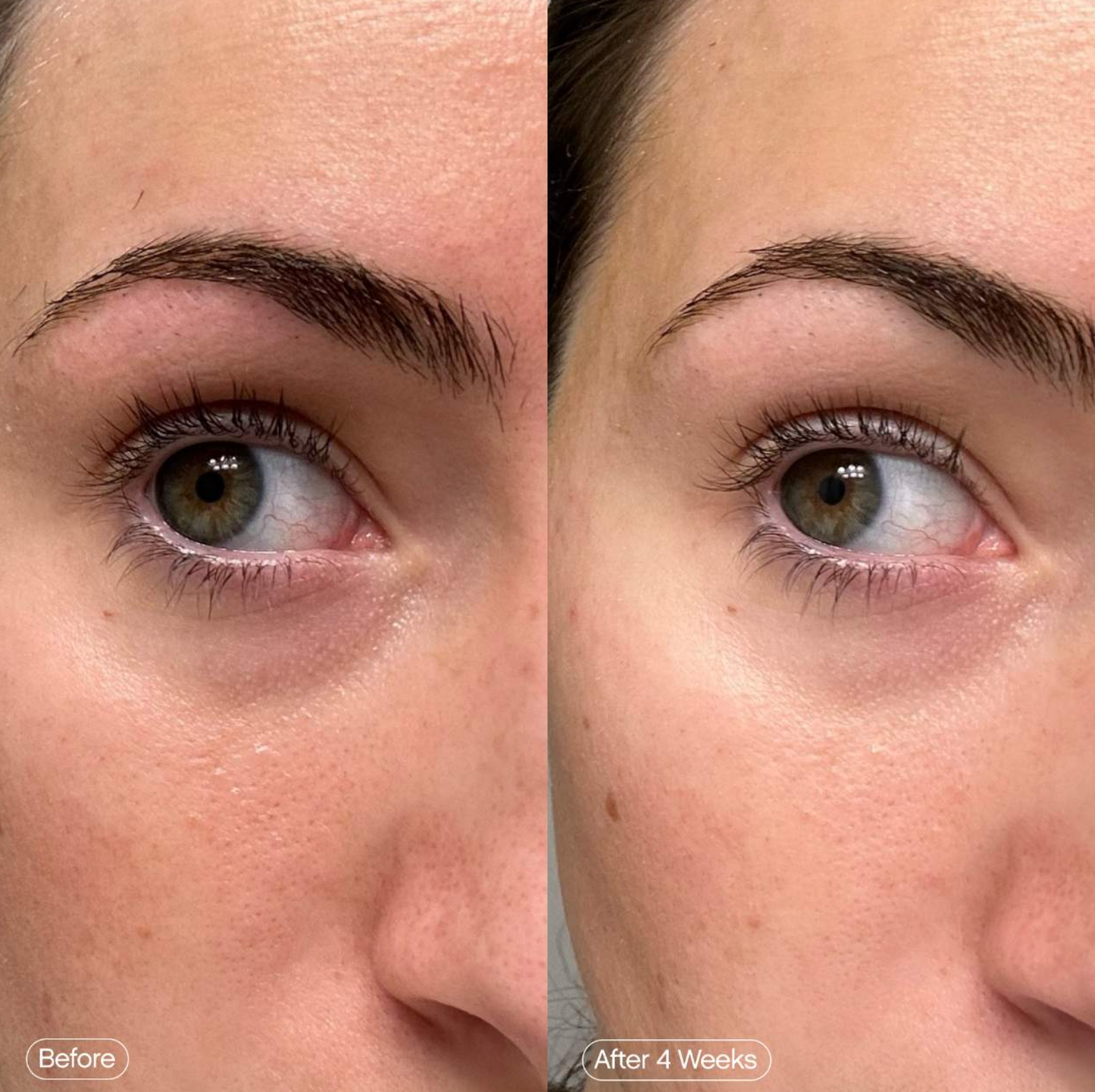 Topicals  Faded Under Eye Brightening & Clearing Eye Masks