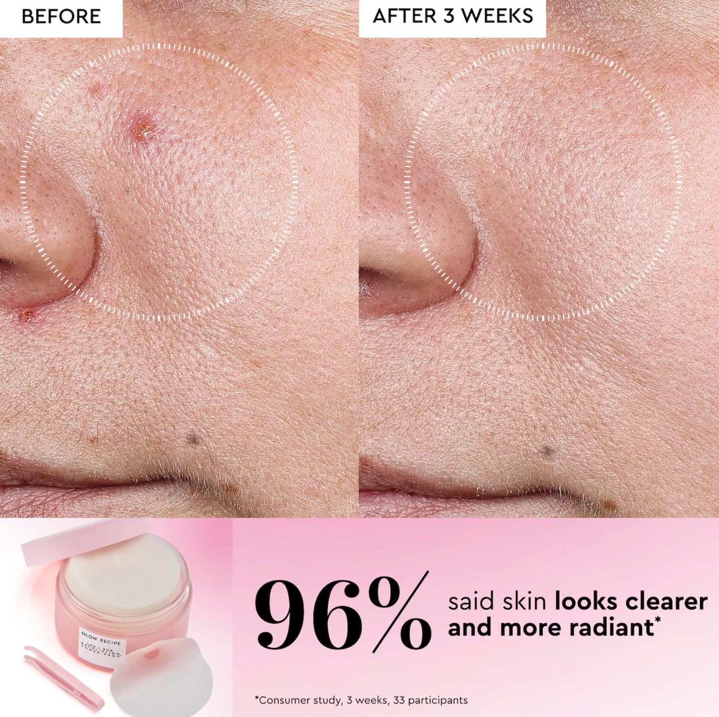 Glow Recipe  LHA + AHA Korean Watermelon Toner Pads for Hydration and Gentle Exfoliation