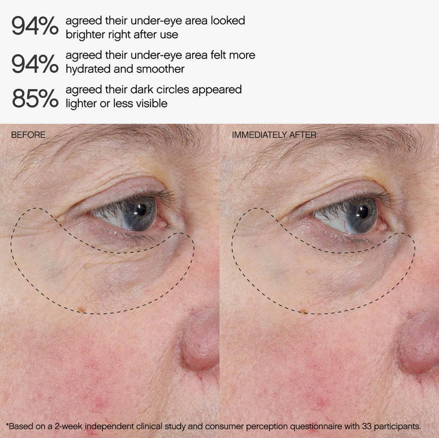 Topicals  Faded Under Eye Brightening & Clearing Eye Masks 6 pack