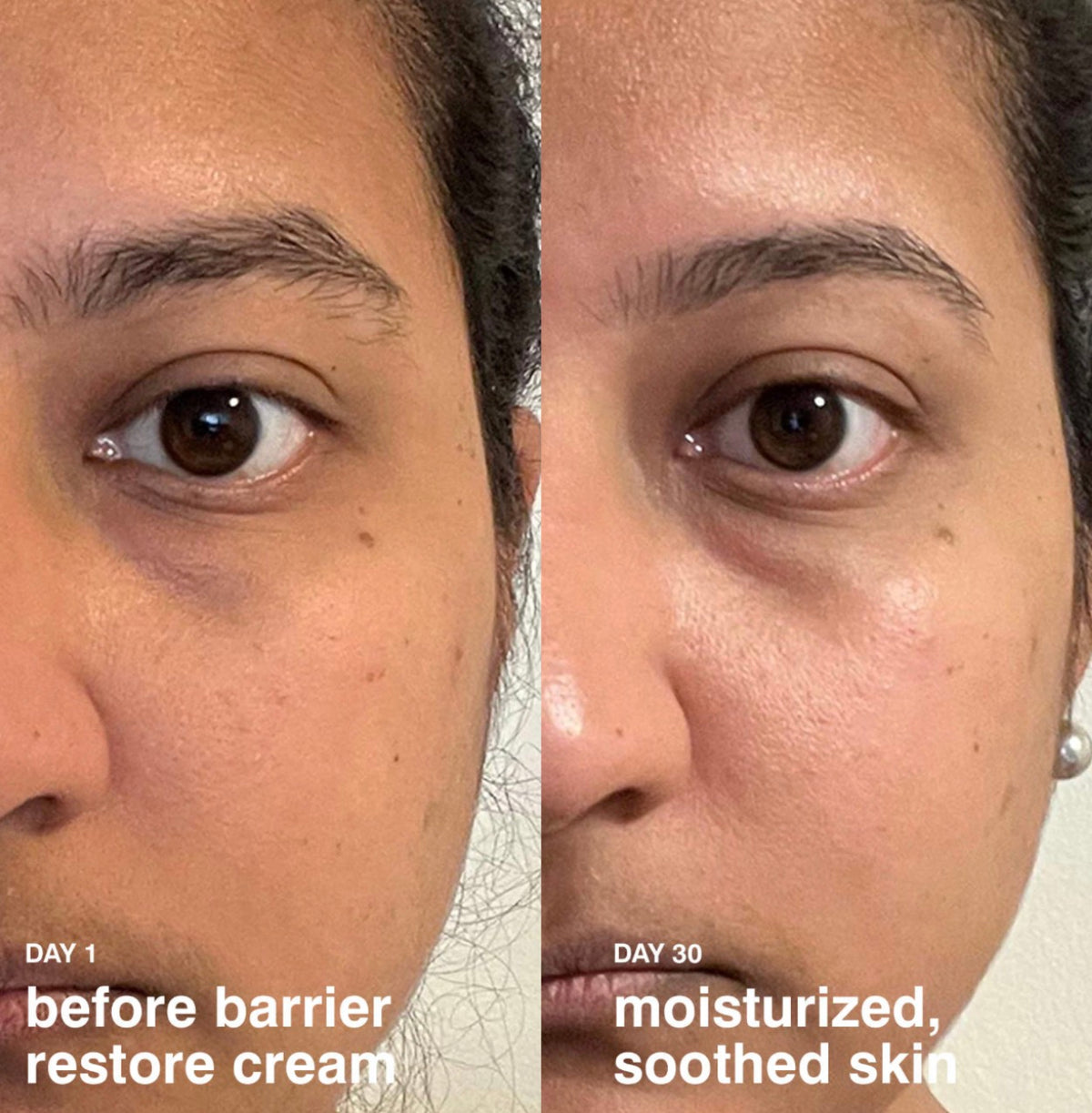 Barrier Restore Cream Hydrating Daily Moisturizer